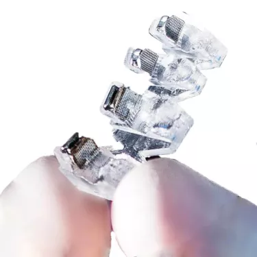 insignia overview bond