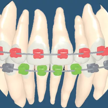 insignia overview design