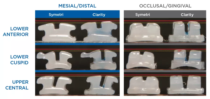 Mesial/Distal vs Occlusal/Gingival